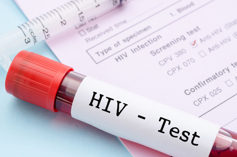 Tratamentul pentru HIV s-ar putea baza pe o singura pilula luata saptamanal
