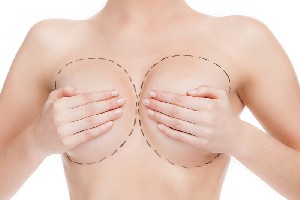 Care este marimea potrivita pentru un implant mamar?